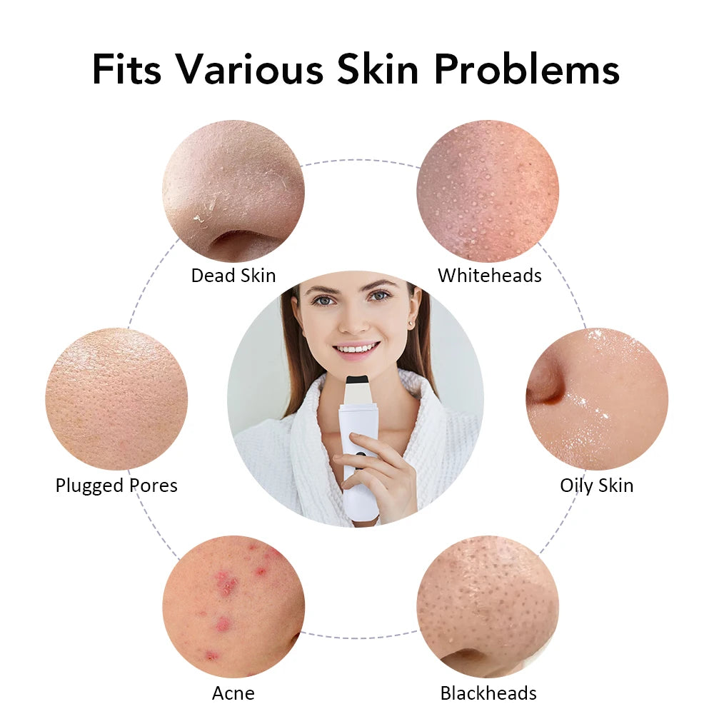 Espátula ultrassônica facial com 4 modos para limpeza de poros em fundo branco