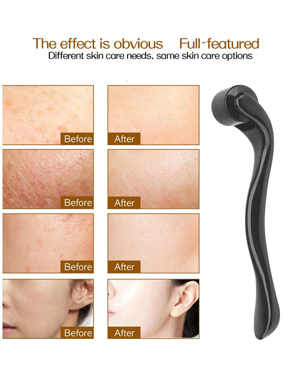 Dermaroller 540 agulhas de titânio para microagulhamento facial em fundo branco