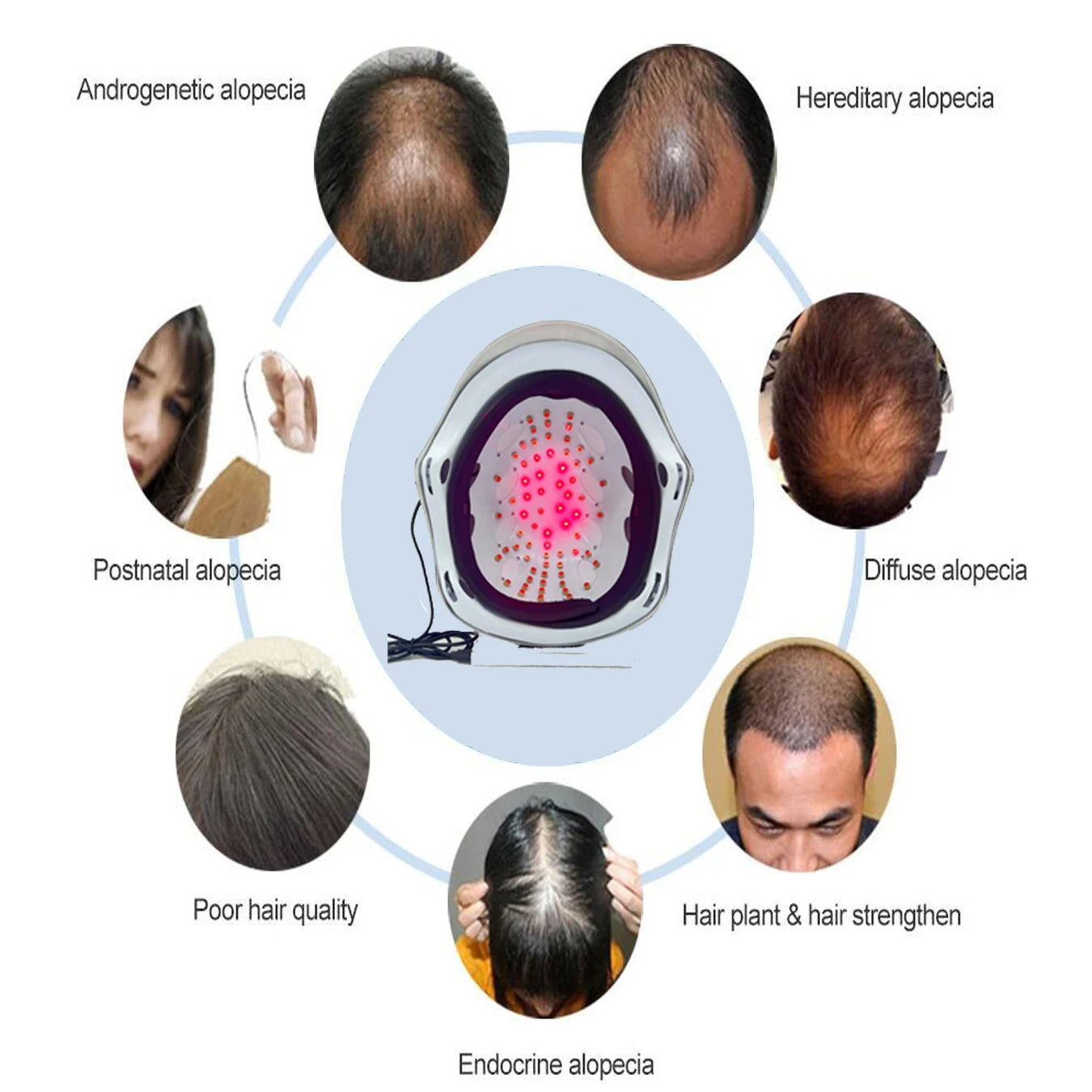 Capacete laser LED fototerapia para crescimento capilar em fundo branco