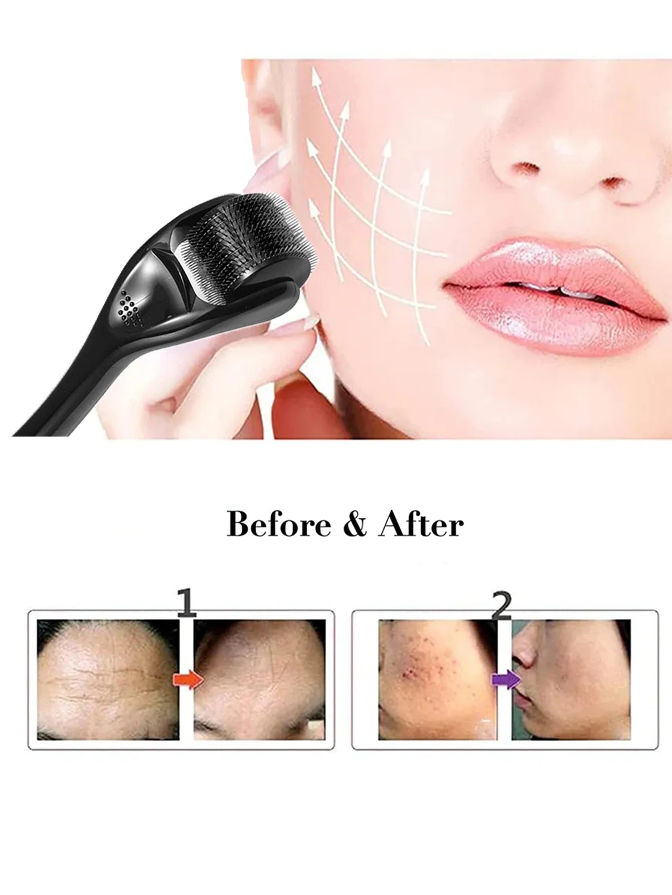 Dermaroller 540 agulhas de titânio para microagulhamento facial em fundo branco