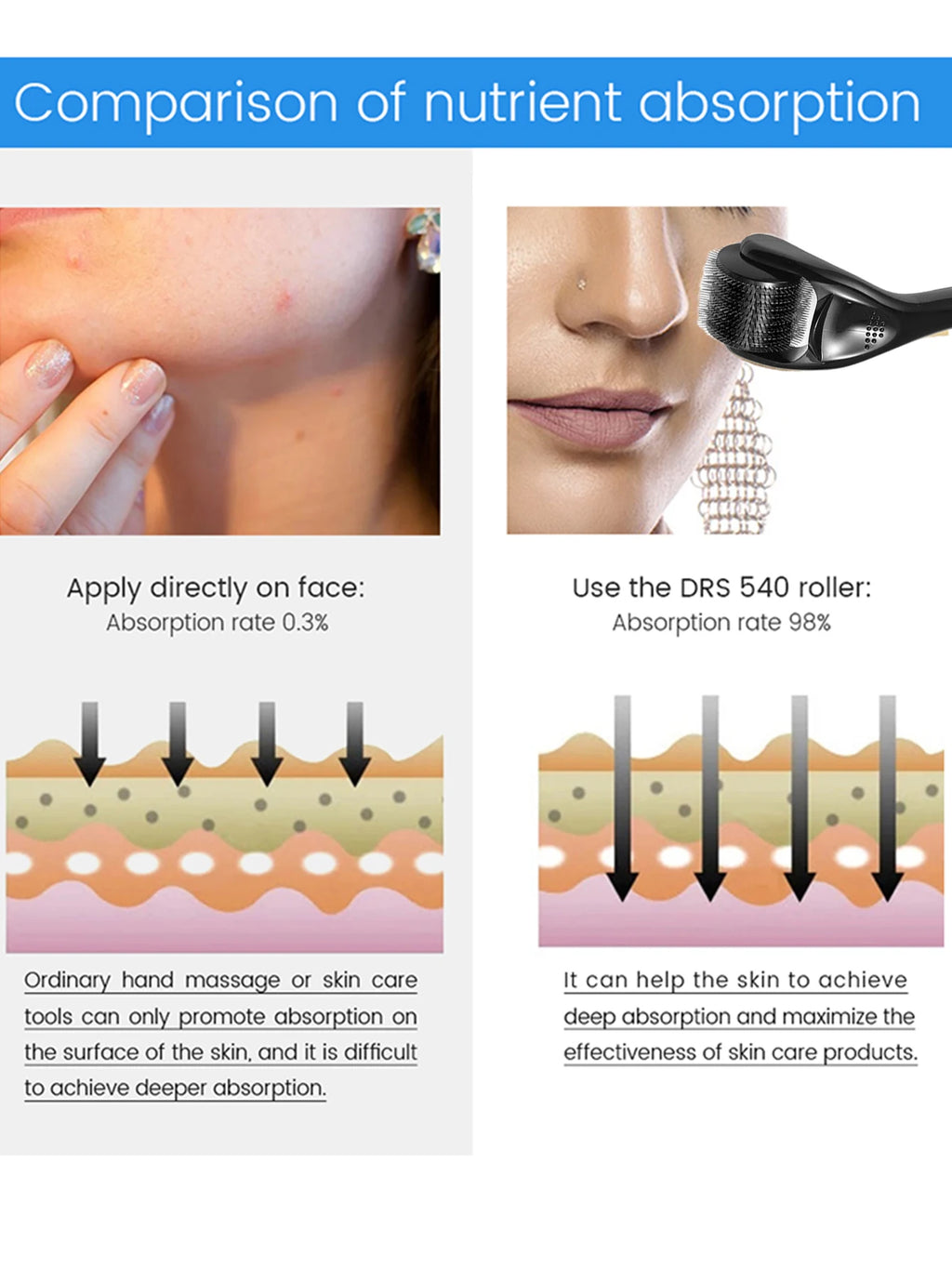 Dermaroller 540 agulhas de titânio para microagulhamento facial em fundo branco